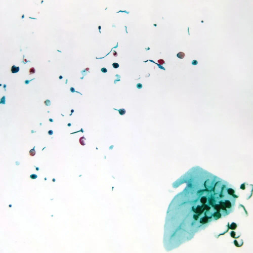 Fern Sori, w.m. Microscope Slide