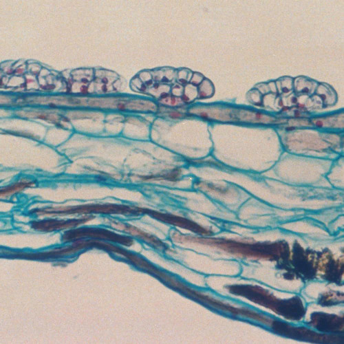 Venus Flytrap Leaf (Dionaea), c.s., Microscope Slide