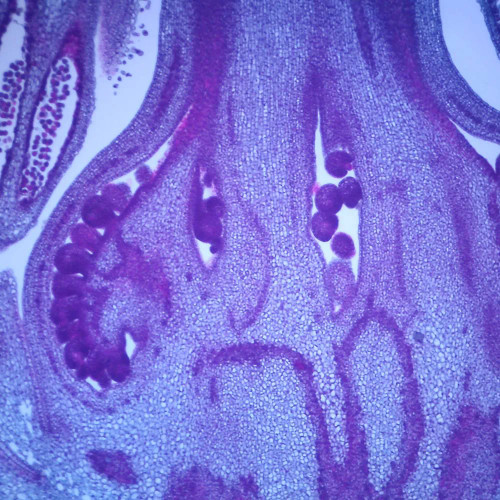 Tomato Flower Bud, l.s., 12 µm Microscope Slide