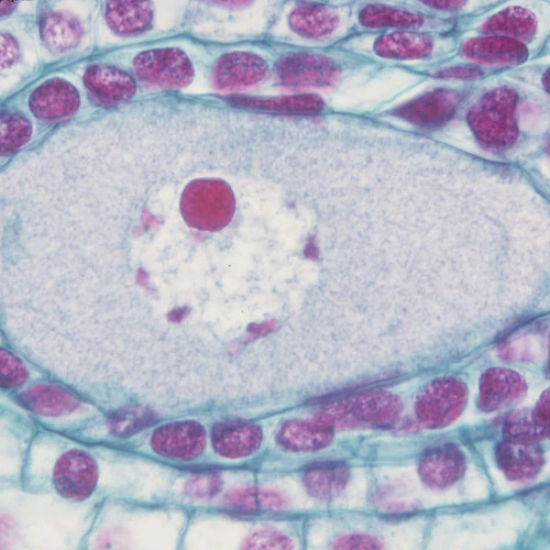 Lily Ovulary, Enlarged Megasporophyte, c.s., 12-20 µm Microscope Slide