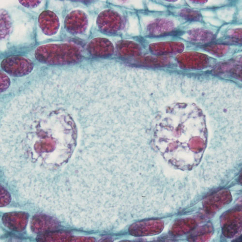 Lily Ovulary, Two Nuclei (Secondary Megasporocytes), c.s., 12-20 µm Microscope Slide