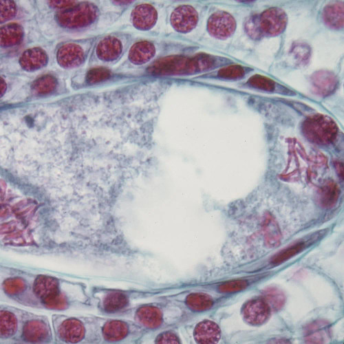 Lily Ovulary, Mature Female Gametophyte (one section), c.s., 12-20 µm Microscope Slide