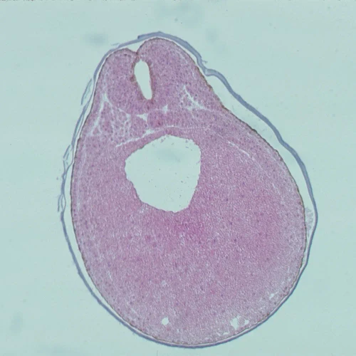 Frog Early Neural Tube, c.s Microscope Slide