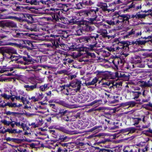 Human Elastic Tissue, sec., 7 µm, Verhoeff stain Microscope Slide