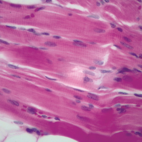 Muscle, Skeletal, Human, c.s. & l.s., Microscope Slide