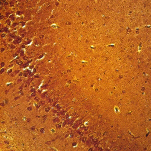 Mammal Cerebrum Pyramidal Neurons, sec. 7 µm silver stain Microscope Slide