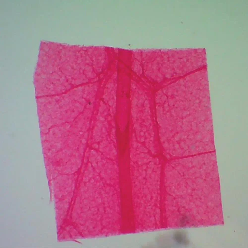 Mammal Lymphatic vessel, w.m. Microscope Slide