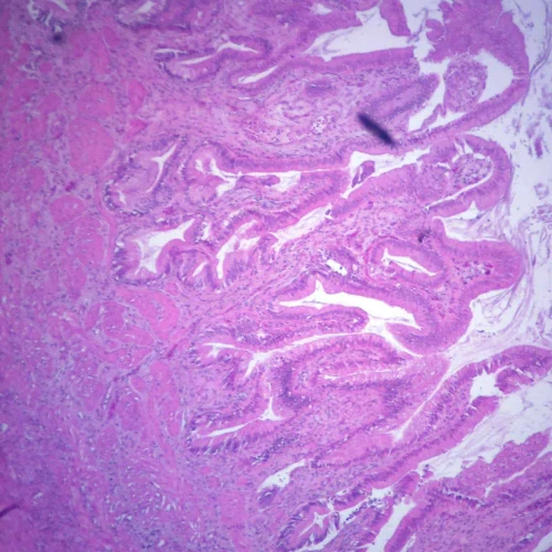 Human Gallbladder - Body, sec. 7 µm H&E Microscope Slide