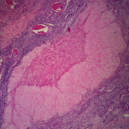 Human Corpus Luteum, sec. 7 µm H&E Microscope Slide
