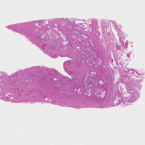 Human Prostate Gland - Young, sec. 7 µm, H&E Microscope Slide