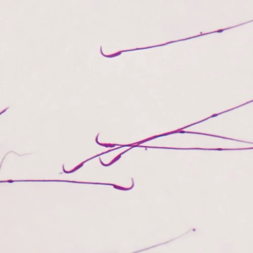 Mammal Rat Sperm, smear Microscope Slide