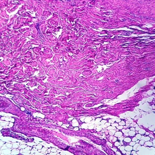 Scar, Microscope Slide