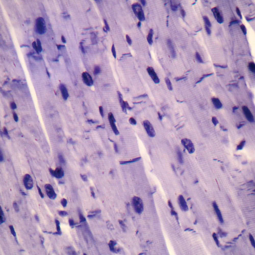 Cardiac Muscle Intercalated Discs