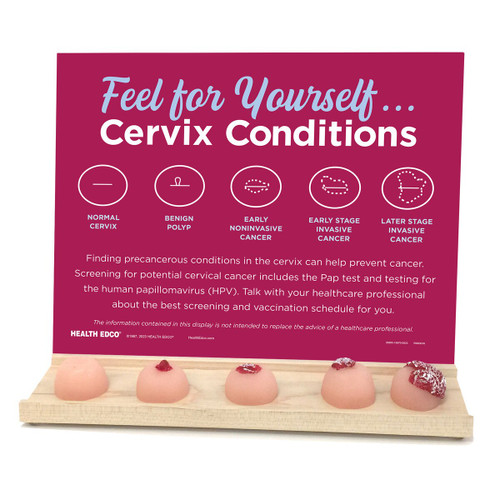 Feel For Yourself: Cervix Conditions