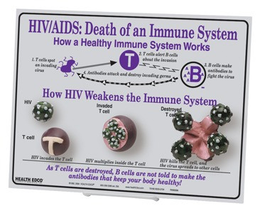 HIV/AIDS Death Of An Immune System Easel Display