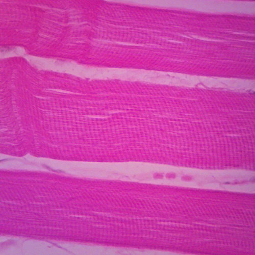 Adult Human Skeletal Muscle Slide, l.s., 7 µm, H&E