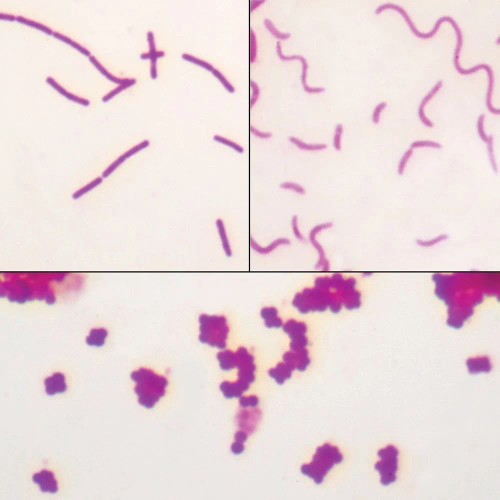 Bacteria Types Slide, Separate Smears, Carbol-Fuchsin