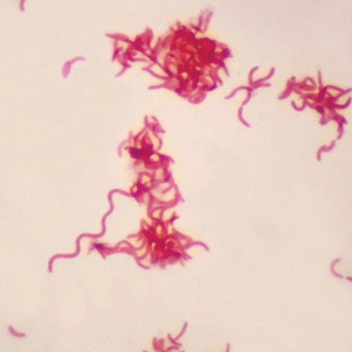 Gram-Negative Spirillum, w.m. Gram stain Microscope Slide