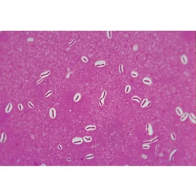 Bacterial Capsules Slide, w.m.