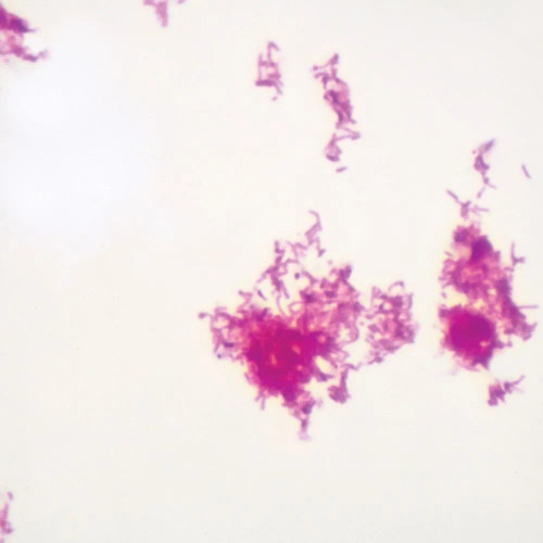 Acid Fast Stain, w.m. Microscope Slide