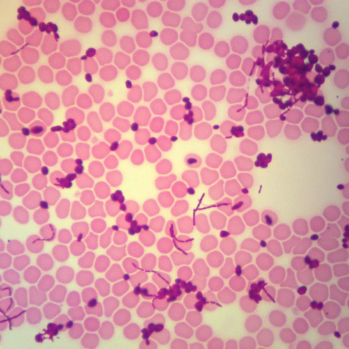 Bacteria, Yeast, and Blood, w.m. Microscope Slide