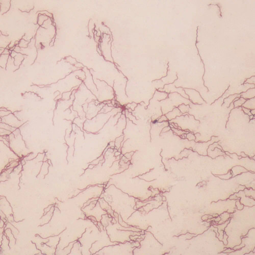 Borrelia burgdorferi, w.m. Microscope Slide