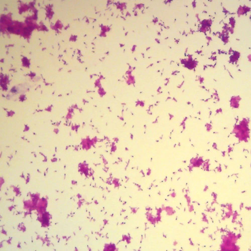 Clostridium tetani, w.m. Microscope Slide