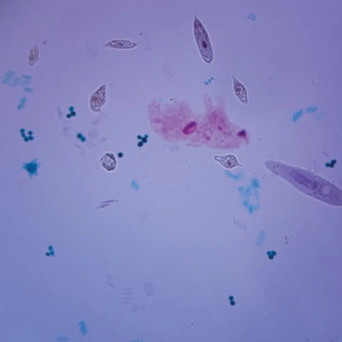 Mixed Protists, w.m. Microscope Slide