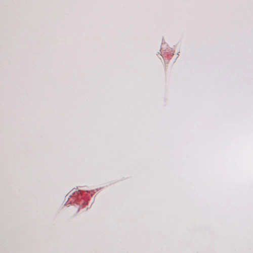 Ceratium, w.m. Microscope Slide