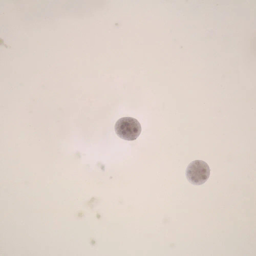 Entamoeba coli Cysts, smear Microscope Slide
