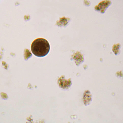 Entamoeba coli Trophozoites, smear Microscope