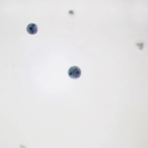Entamoeba histolytica Cysts, smear Microscope Slide