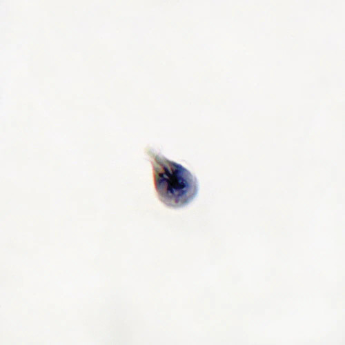 Giardia lamblia Trophozoites Slide, Smear, HH
