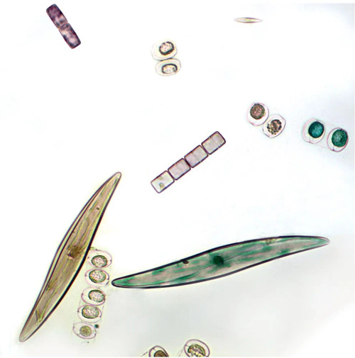 Freshwater and Marine Diatoms, w.m. Microscope Slide
