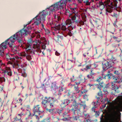 Lichen Thallus, sec., 12 µm Microscope Slide