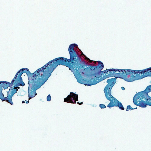Lichen Ascocarps, sec., 12 µm Microscope Slide