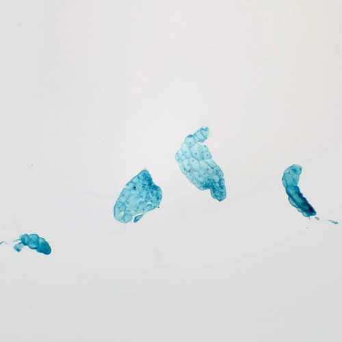 Fern Prothallium, Filamentous, w.m. Microscope Slide