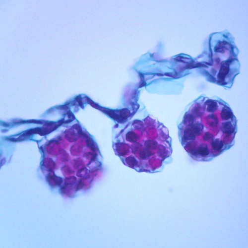 Fern Antherida, section Microscope Slide