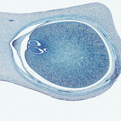 Zamia Young Ovule, l.s., 12 µm Microscope Slide
