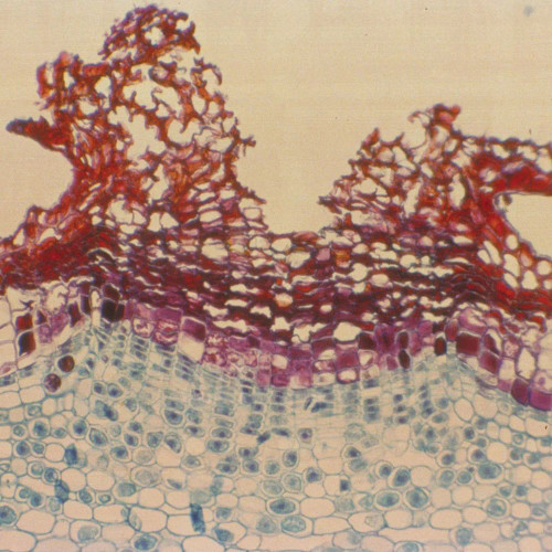 Elderberry Lenticel, c.s., 12 µm Microscope Slide