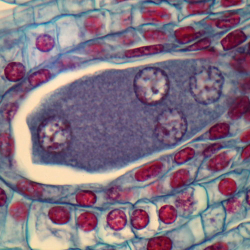 Lily Ovulary, First 4-Nucleate Stage (Megaspores), c.s., 12-20 µm Microscope Slide
