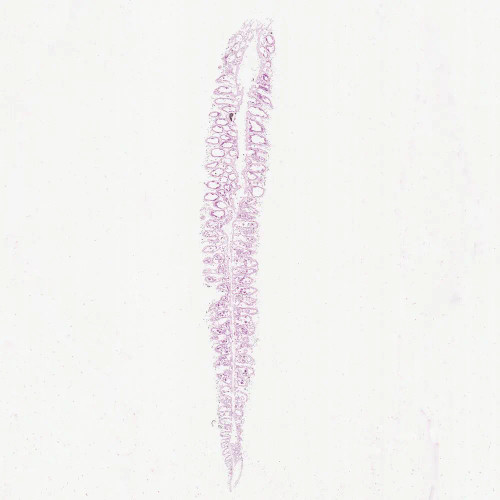 Grantia, Near median l.s. Microscope Slide