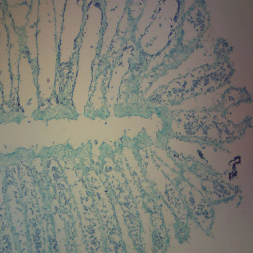 Grantia Spicules, c.s. 15 µm, H&E Microscope Slide