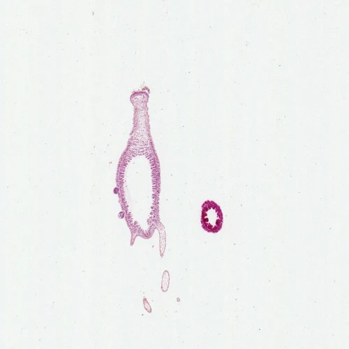 Hydra, c.s. and l.s. H&E Microscope Slide