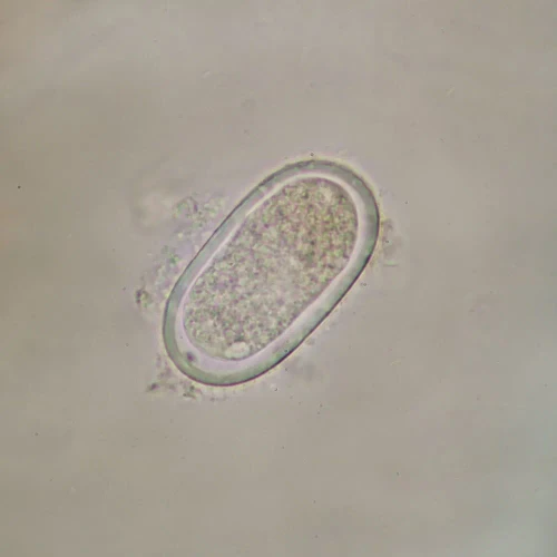 Enterobius vermicularis Eggs, w.m. Microscope Slide