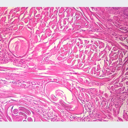 Human Helminth Eggs, w.m. Microscope Slide