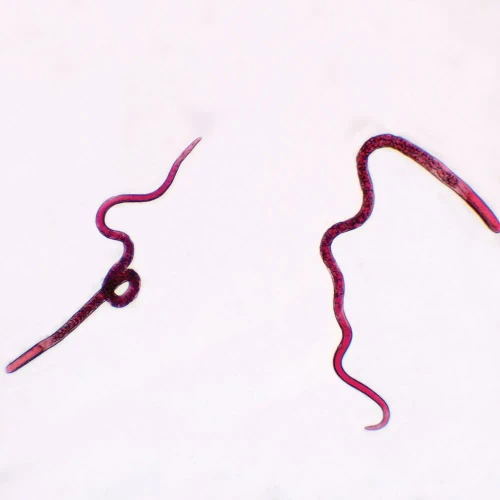 Trichinella spiralis Female, w.m. Microscope Slide