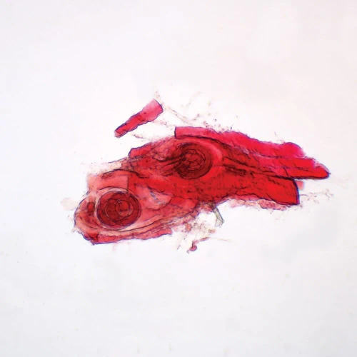 Trichinella spiralis Encysted Larvae, w.m. Microscope Slide