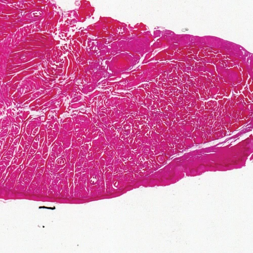 Trichinella spiralis Encysted Larvae, 7 µm H&E Microscope Slide