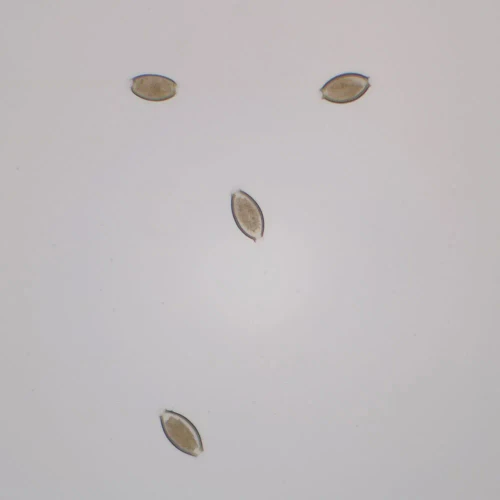 Trichuris trichiura Eggs, w.m. Microscope Slide